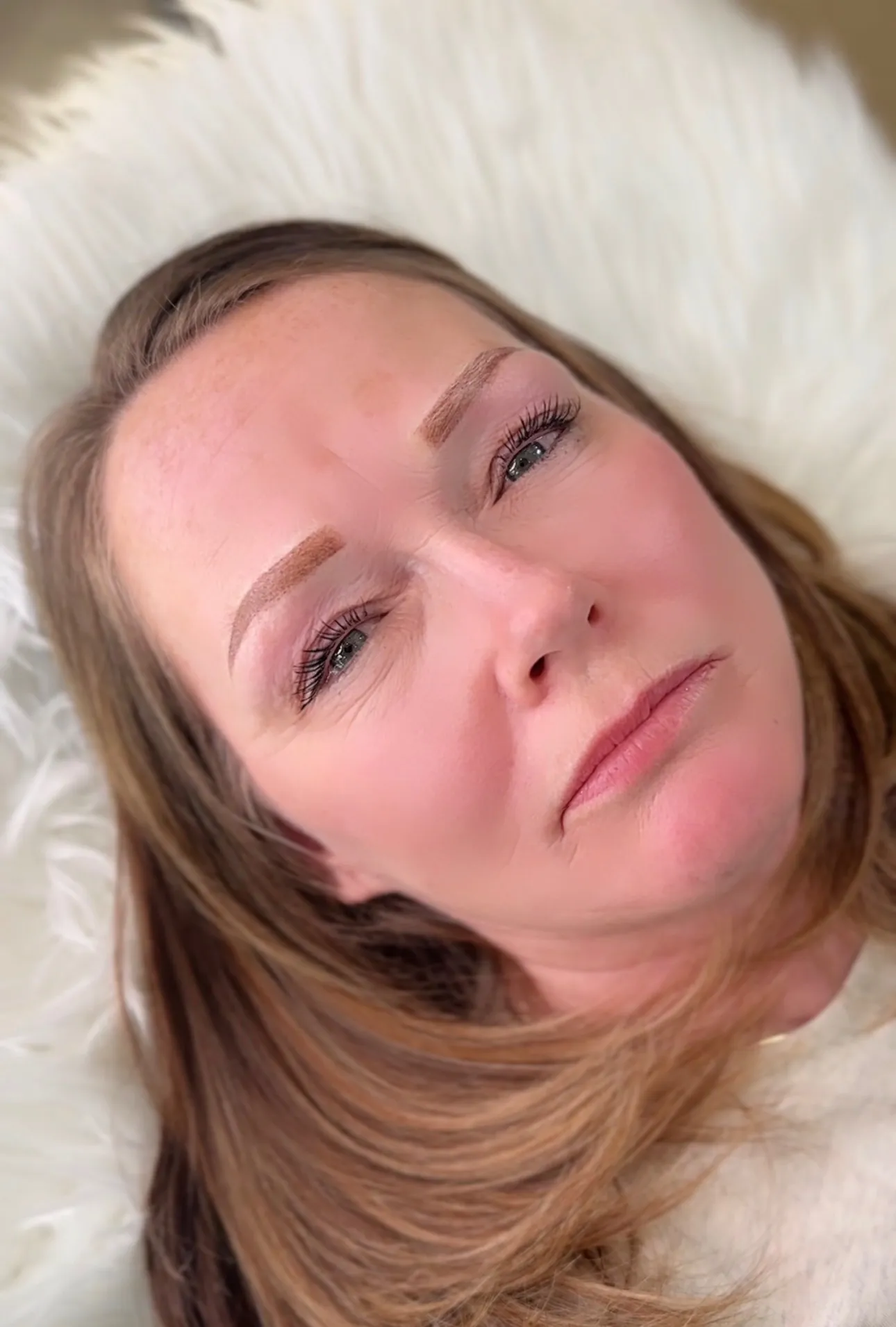 After brow treatment