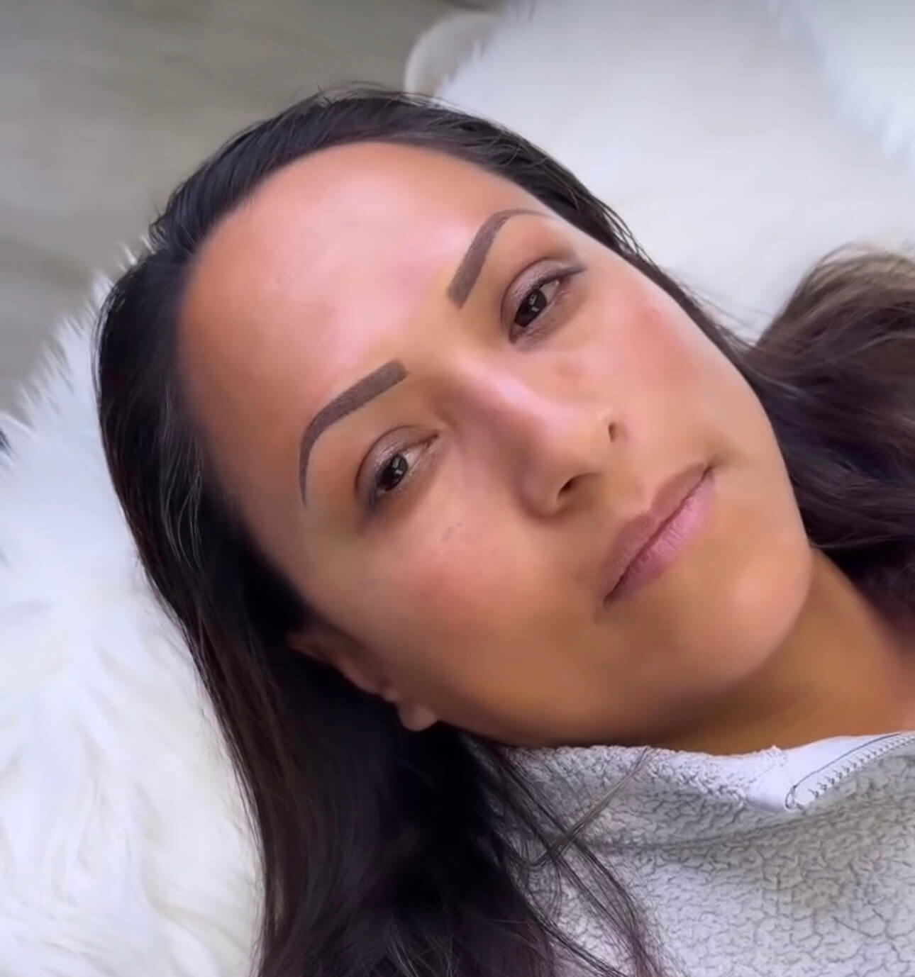 After brow treatment